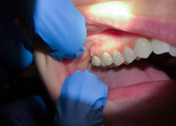 Best Emergency Dental Filling Replacement  in Holt, MI