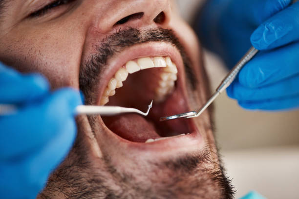 Best Emergency Dental Clinic in MI